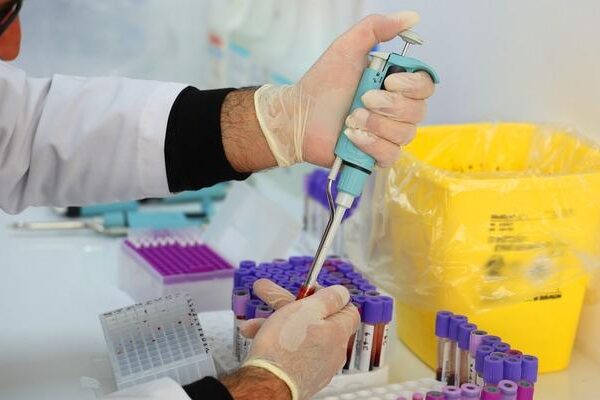 Göreceli düğünler SMA ile doğumları tetikler! Uzman ‘Bu 6 İl Çiftler Testi ile Evlenecek “!